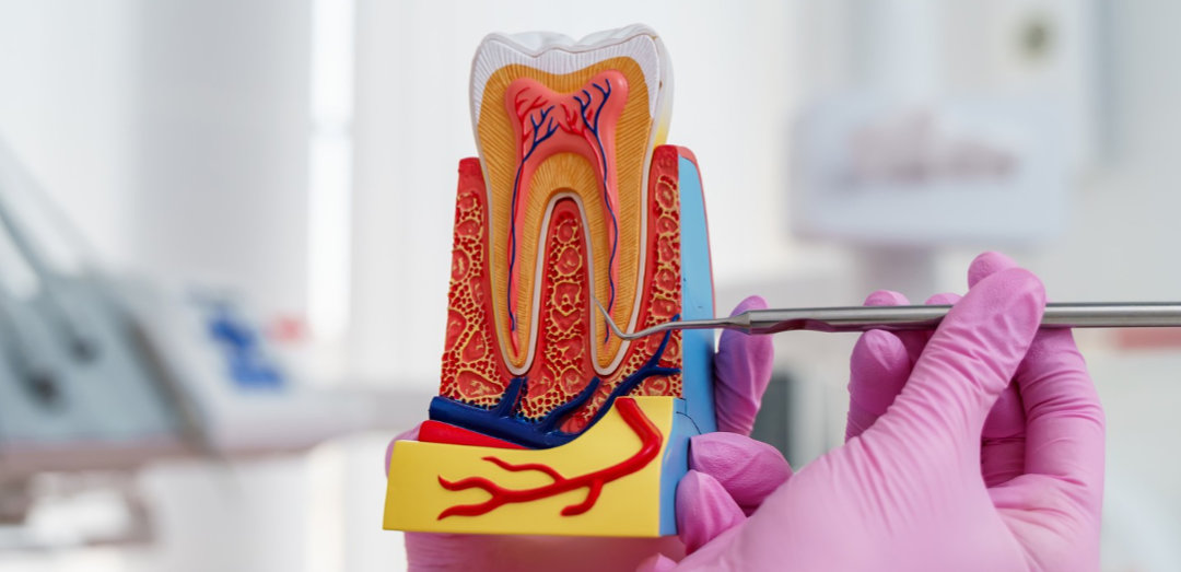 Seitlich offenes Zahnmodell